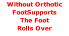 Without Orthotic FootSupports  The Foot  Rolls Over